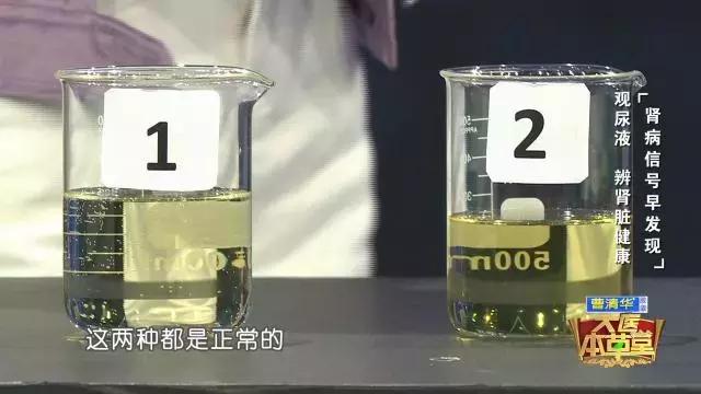 一定不要這樣喝水，會「毀掉」自己的腎，出現這種症狀表示腎臟受損