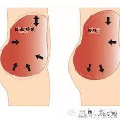 每天這樣做「甩手操」，甩掉一身疾病讓你「通體舒暢」！