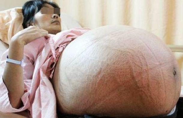 25歲產婦剖腹產子，孩子一出生30幾個父親爭相搶抱孩子，事實淚目