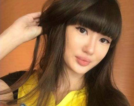 排球美少女「奇蹟天使變網紅臉」 詭異厚唇讓粉絲：還我清純妹子 