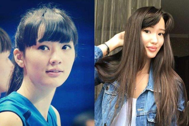 排球美少女「奇蹟天使變網紅臉」 詭異厚唇讓粉絲：還我清純妹子 