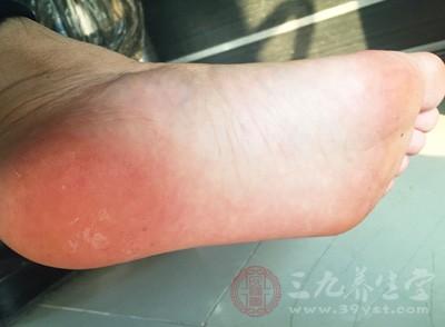 你的身體足夠健康嗎？看腳竟能判斷出你的身體好不好，趕緊對照看看吧！