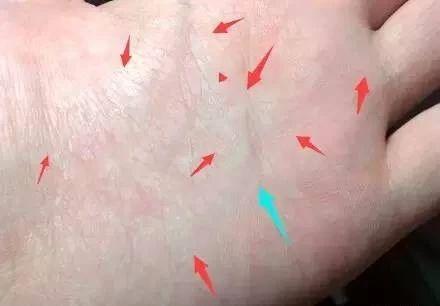 手診七質辨證：虛、淤、毒、痰、鬱、特、平