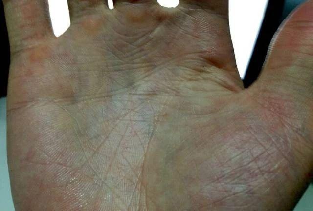 手診七質辨證：虛、淤、毒、痰、鬱、特、平