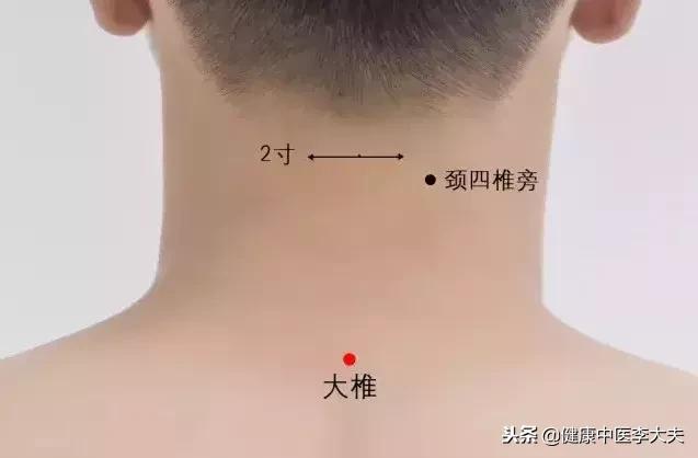 脖子後面的大椎穴，「克制」頸椎病，收藏了！