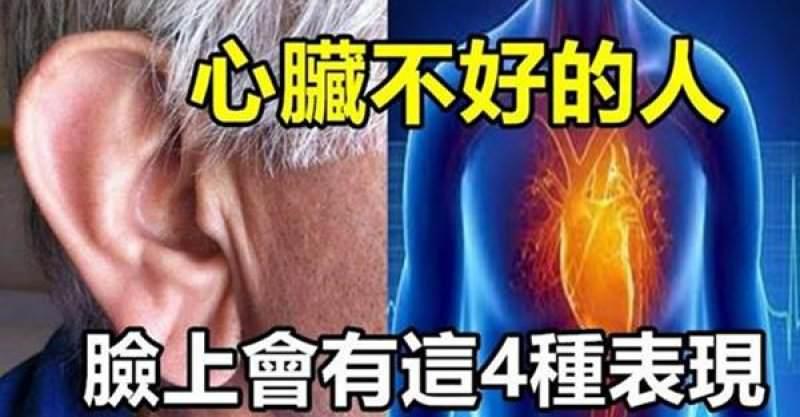心臟不好的人，臉上會有這4種表現，趕緊去檢查吧！