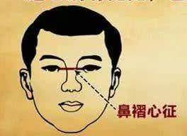 心臟不好的人，臉上會有這4種表現，趕緊去檢查吧！