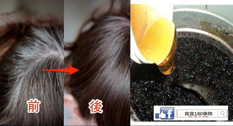 「白頭髮」終於有解！八個食療小偏方能預防白髮，簡直太神了，食材簡單到不行阿！ 