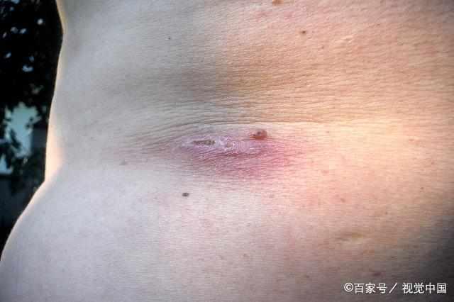 有這10種特徵的最易得癌，看看你和家人有沒有？