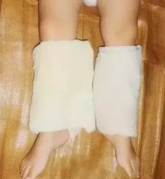 媽媽把濕毛巾綁在孩子的腿上,簡單的自療法,有孩子的必須看!