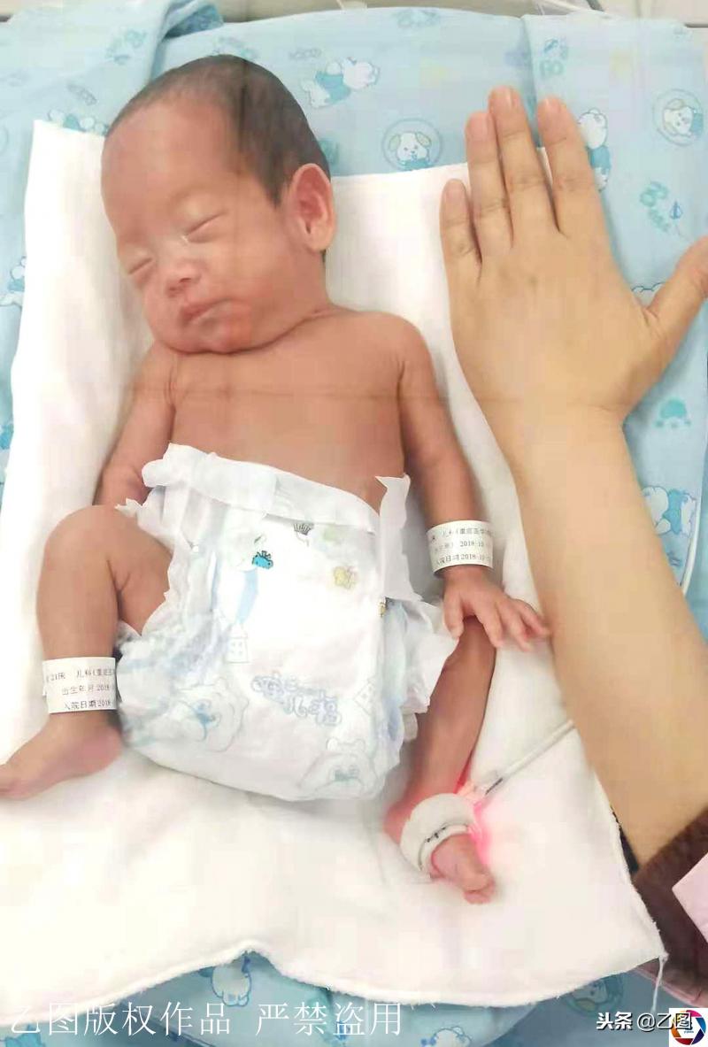 孕婦懷孕6個月在家產「掌心寶寶」，急壞家人，住保溫箱2月活下來
