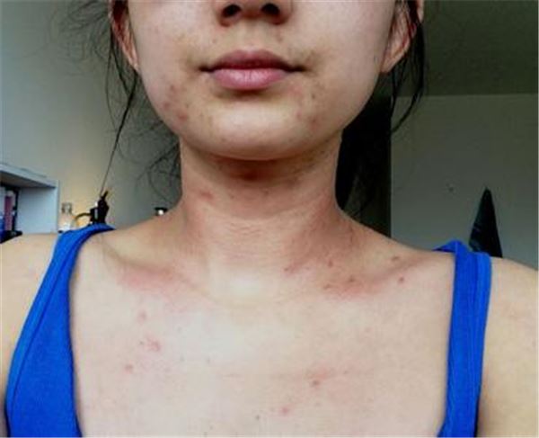 腎好人不老！當你發現身體出現這「六大警示」後，表示腎臟在求救！