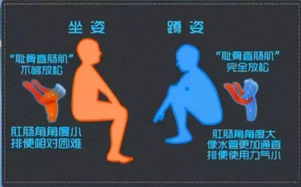 越來越多人衛生間不裝馬桶了，現在流行這樣裝