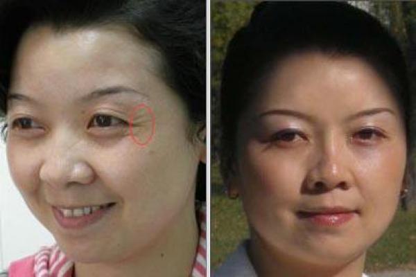 好神奇！三分鐘後眼袋 、魚尾紋全消失了！居然只要在水裡加入（這個東西）