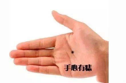 身上這十處痣，都是有福有財的好痣，有一顆就發達了！