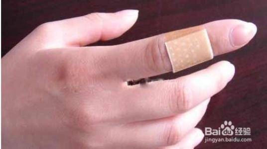 婦人打掃完家裡「8根指頭焦黑」慘變枯枝！連醫生也搖頭嘆：她太粗心了