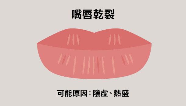 看唇色秒懂健康，中醫教你如何改善自身狀況