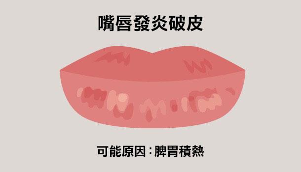 看唇色秒懂健康，中醫教你如何改善自身狀況