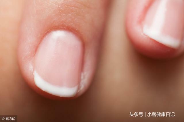 肝好不好，看這些地方有沒有「變黑」！枸杞換一種吃法最養肝 