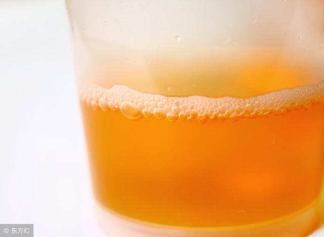 腎臟出問題？4項檢查 3大飲食禁忌 不看就糟了