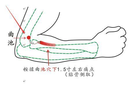皮膚濕疹總不好？中醫主任：這4個巧方法，相互結合，濕疹全消