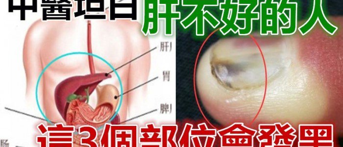 中醫坦白：肝不好的人，這3個部位會發黑！秋季多吃3種改善肝功能的食物 