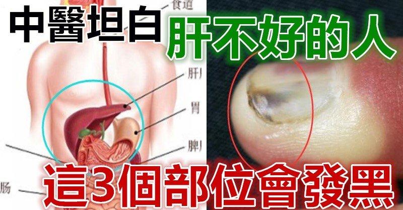 中醫坦白：肝不好的人，這3個部位會發黑！秋季多吃3種改善肝功能的食物 