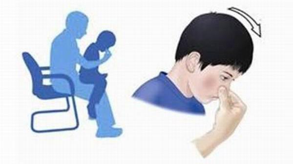 兒童燙傷、劃傷、扭傷、流鼻血的急救處理誤區