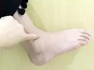 人體自帶的3個「消炎穴」，常按不上火，可惜識貨的人太少！