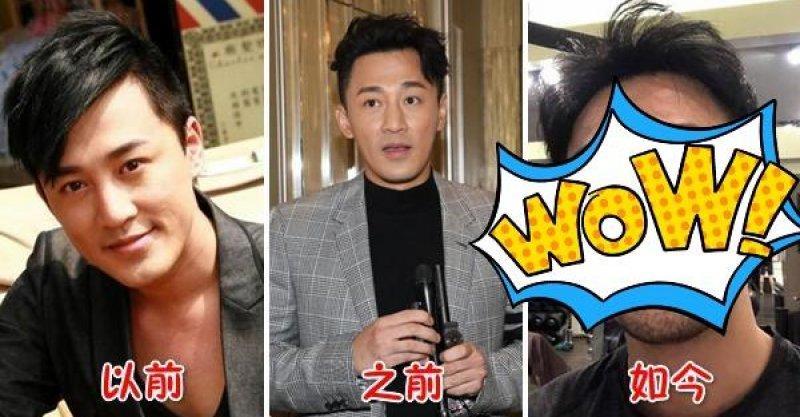 林峰近照曝光大變樣，曾經的陽光型男，如今竟變成邋遢大叔，網友：他究竟經歷了什麼?
