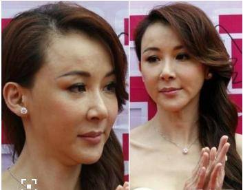 當50歲邱淑貞撞上50歲的蕭薔，整沒整容，差距一目了然！