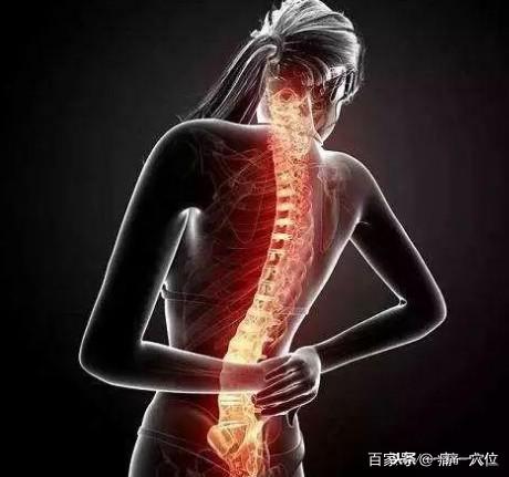 一痛一穴位：急性腰扭傷，找痛點選穴位，早看早受益！