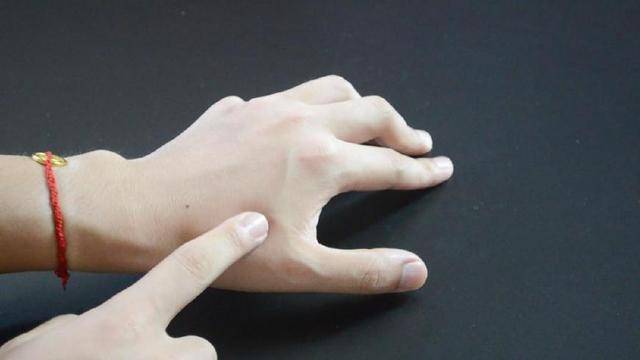 一瓶過期的眼藥水，原來還能這麼用，可惜很多人都扔了!