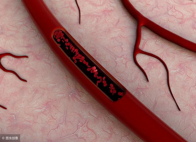 腳部有「化血栓開關」多做3個小動作，把血栓通通化解