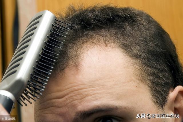 男性為什麼容易脫髮？主要是這幾個原因！