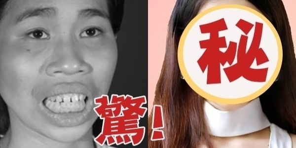 女兒「整容成正妹」！卻遭聾啞母推開「拒相認」大哭質問「你是誰」？