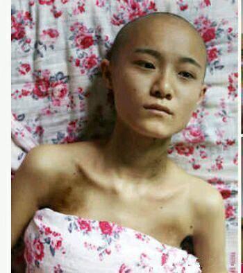 23歲胃癌晚期，醫生說天天吃這三樣誰都容易患癌！