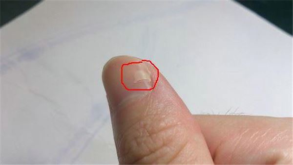 指甲出現這「5種狀況」千萬不要忽視，很可能是身體大病的前兆！ 