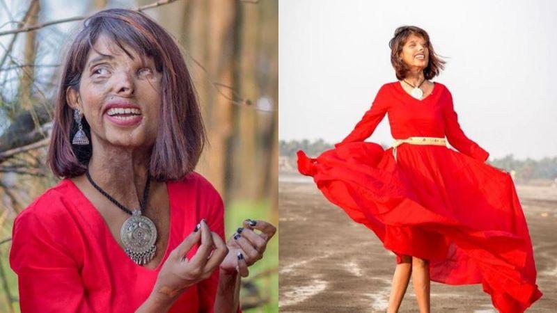  被狠父潑酸大復仇！ 正妹「整臉融化」活得比誰都幸福