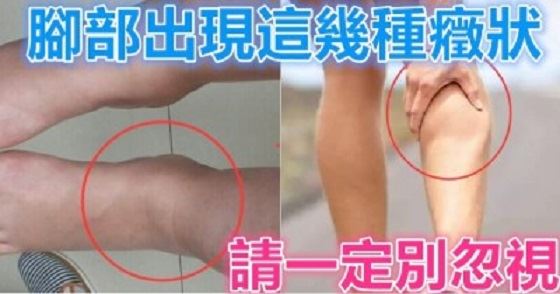 樹枯根先竭，人老腳先衰！腳部出現這幾種癥狀，請一定別忽視！可能是這些疾病的信號！ 