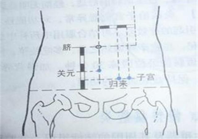 止痛，你還只想到止疼片？那你就錯了，常用的「止疼穴」，請收藏