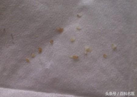 下巴上長出許多白色的小點點，是怎麼回事兒？該怎麼處理呢？