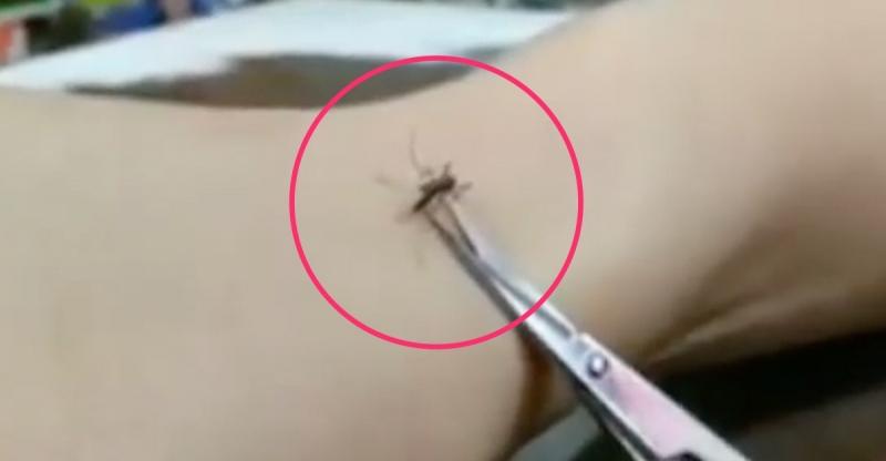 他趁蚊子吸血吸超爽時拿剪刀靠近，神手一剪後出現的「超狂畫面」讓40萬網友High爆了！