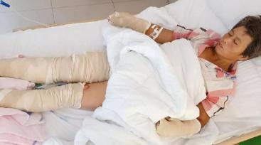 午睡奶奶開了一下空調，3歲美貌小女孩變成紗布人，女孩總和爸爸說：爸爸，我疼...打工父母傷心欲絕