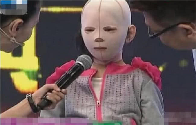 10歲女孩整天帶著「頭套」，同學都嘲笑她是「怪物」，摘下面具後眾人淚奔！