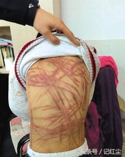 四歲男孩喊肚子疼，父親帶他醫院檢查，醫生瞞著父親報了警