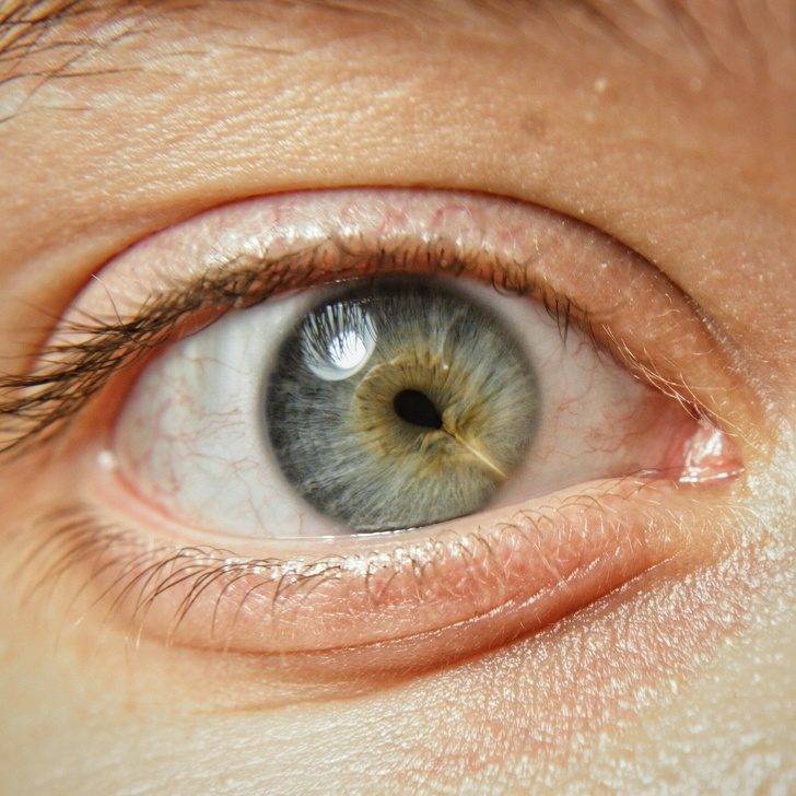 一個眼睛兩個瞳孔！20張證明「你根本就不了解人類」的罕見人類照