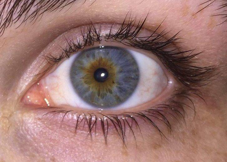 一個眼睛兩個瞳孔！20張證明「你根本就不了解人類」的罕見人類照