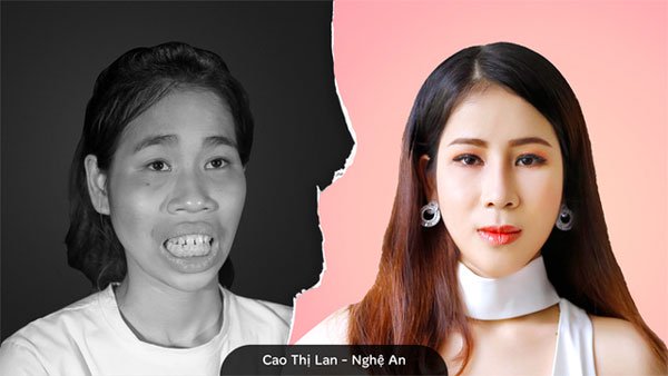 越妹整容整太美 媽媽嚇到推開她