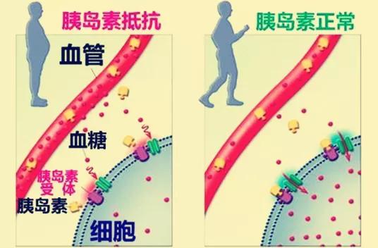 肥胖糖尿病人，當心胰島素抵抗七大危害！